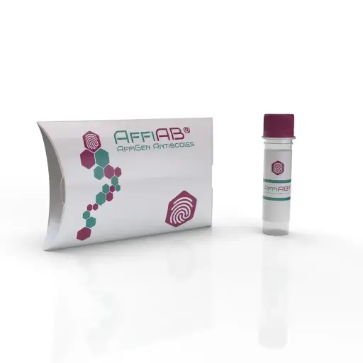 [ABD6424] NOS1 Antibody - 100µg